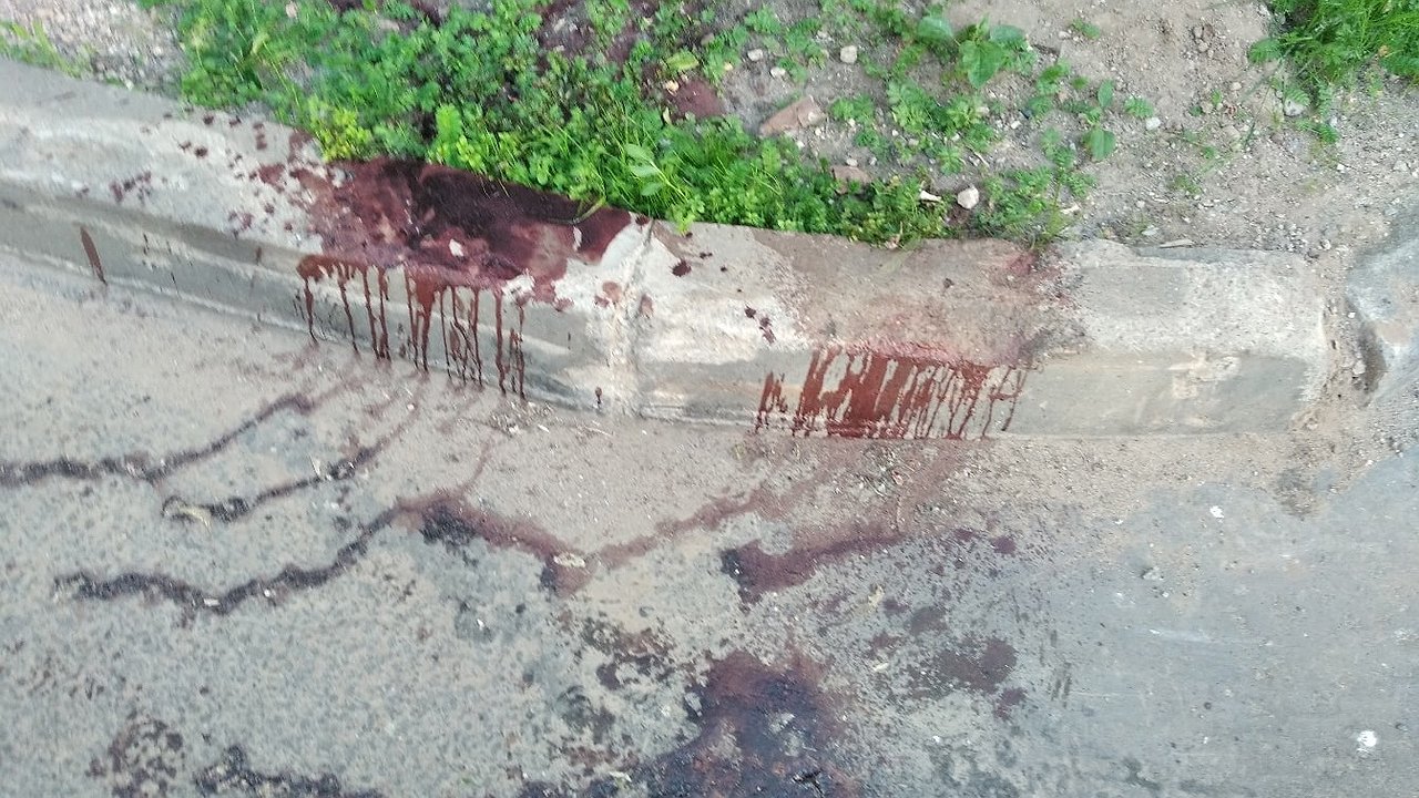 Главная картинка новости: В Костроме пьяный студент, стреляя из пневматики попал в ногу 6-летней девочки