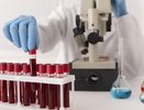Ученые выяснили, что людей с этой группой крови называют «золотыми» - они самые умные и эрудированные: проверьте себя