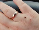 В Костромской области выявили первый случай клещевого энцефалита