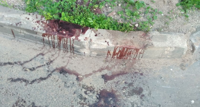 В Костроме пьяный студент, стреляя из пневматики попал в ногу 6-летней девочки