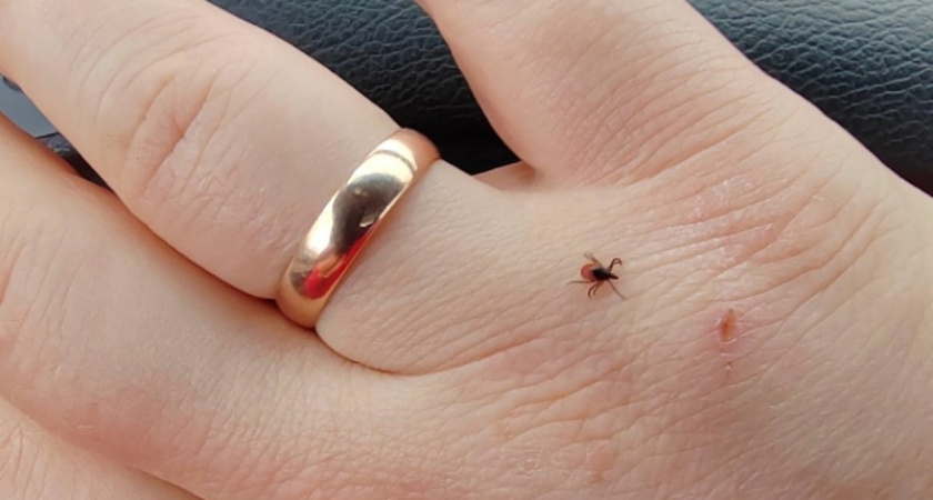 В Костромской области просыпаются клещи: как защитить себя от укуса