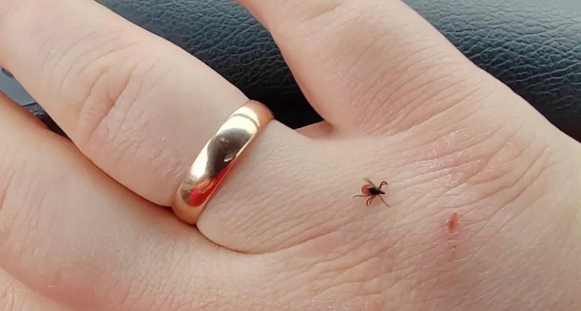 В Костромской области выявили второй случай клещевого боррелиоза