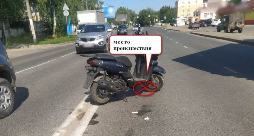 Водитель скутера в Костроме не справился с управлением и угодил в больницу