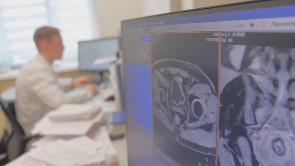 Врачи Костромы научились находить рак новым методом