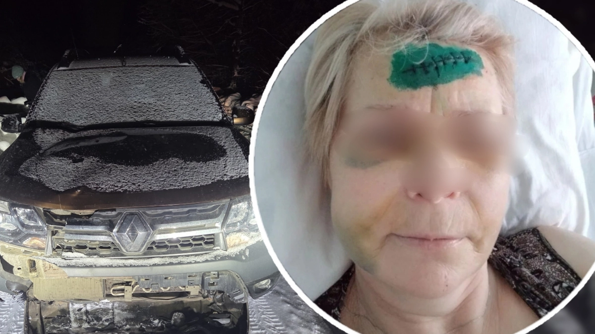 «Тащил без сознания за капюшон»: сбившего женщину пьяного водителя просто лишили прав